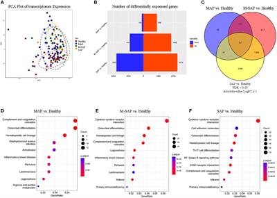 Identification of novel immune-related targets mediating disease progression in acute pancreatitis